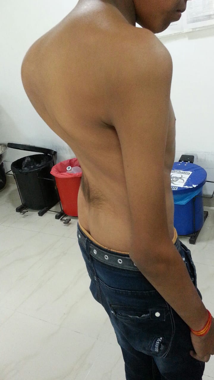 cervical
