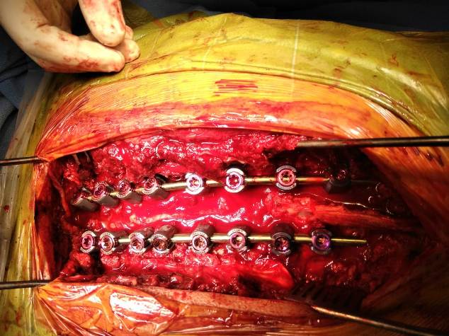 cervical